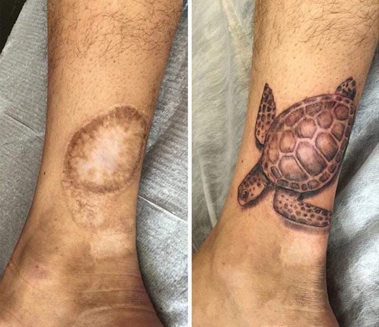 Las soluciones más divertidas para transformar una cicatriz en un original tatuaje 5