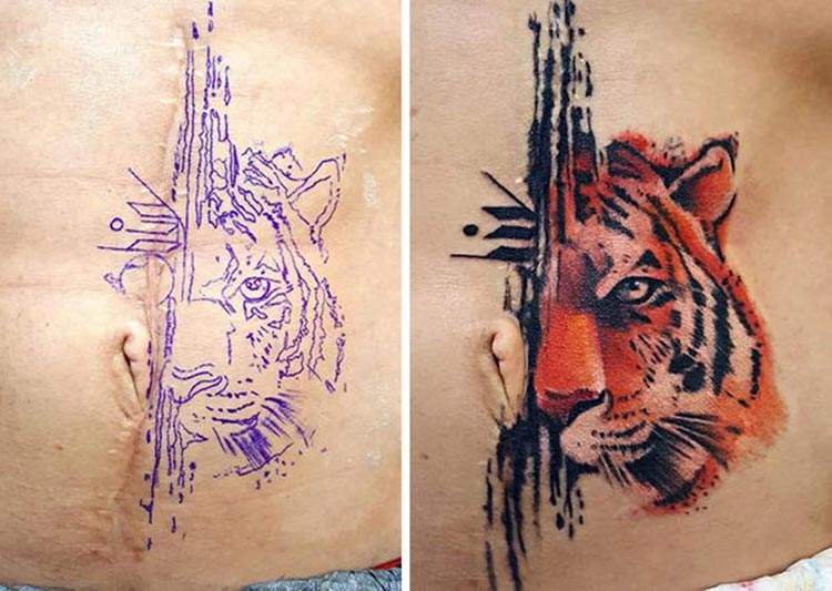 Las soluciones más divertidas para transformar una cicatriz en un original tatuaje 4